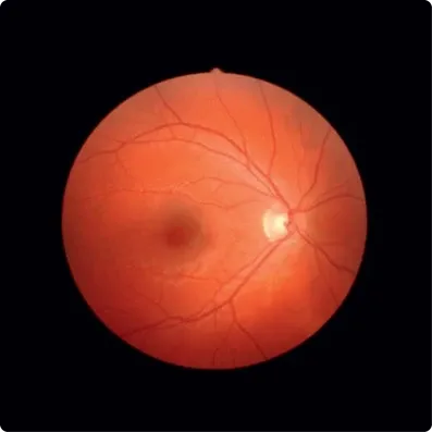 Fundus